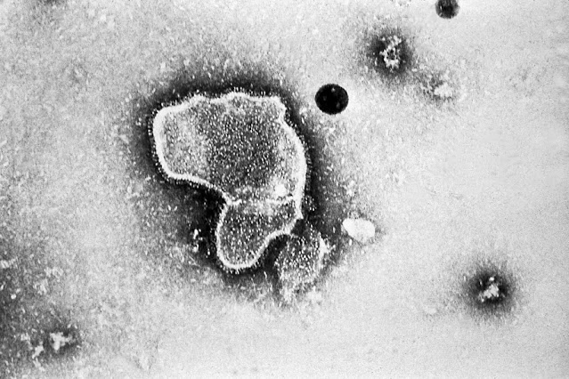 Metapneumovírus Humano: aumento de casos na China preocupa autoridades de Saúde